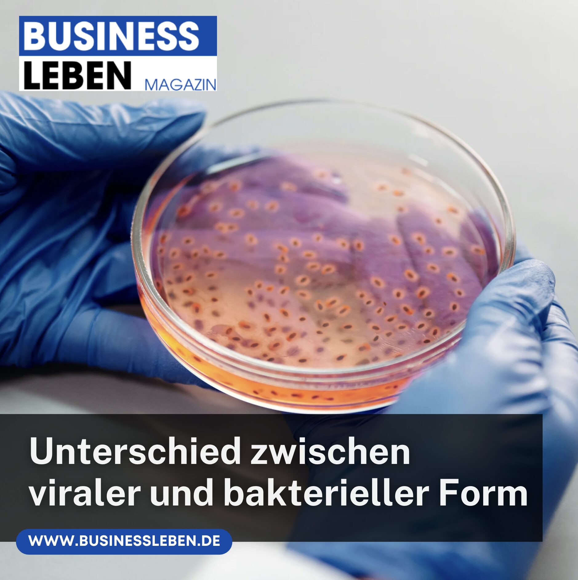 Unterschied zwischen viraler und bakterieller Form Bindehautentzündung