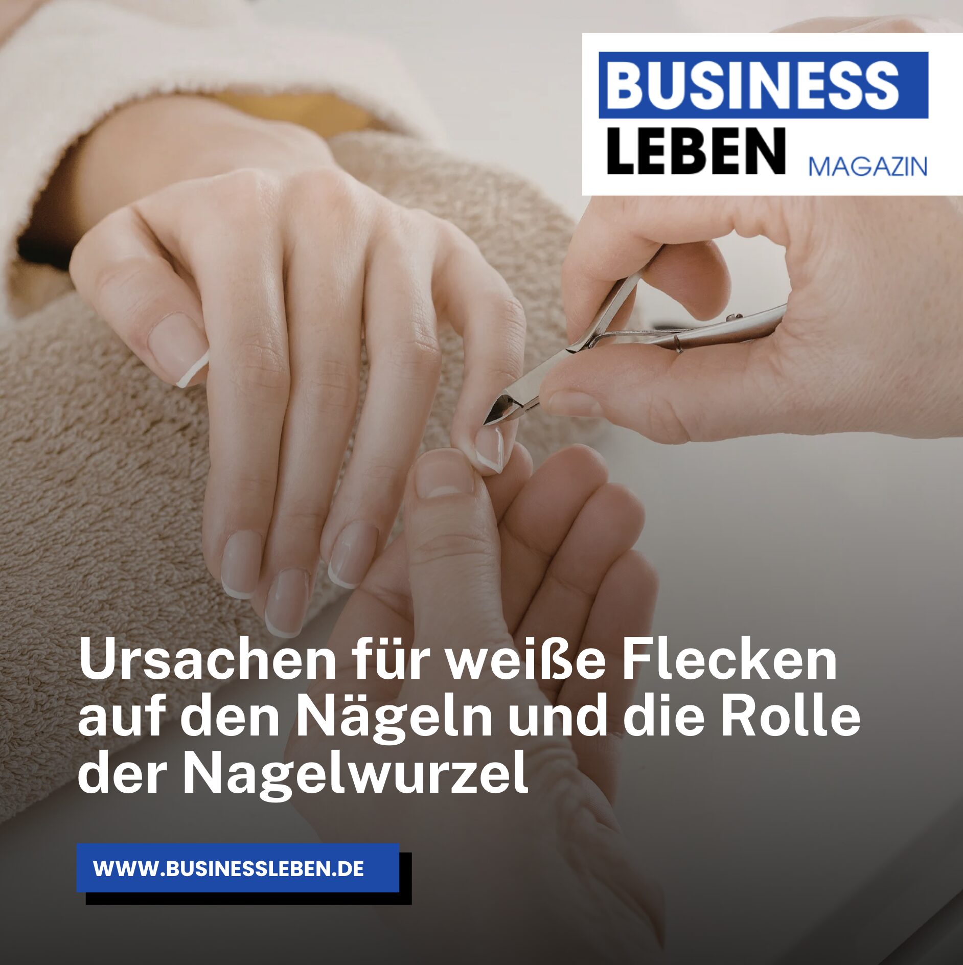 Ursachen für weiße Flecken auf den Nägeln und die Rolle der Nagelwurzel Ursachen für weiße Flecken auf den Nägeln und die Rolle der Nagelwurzel
