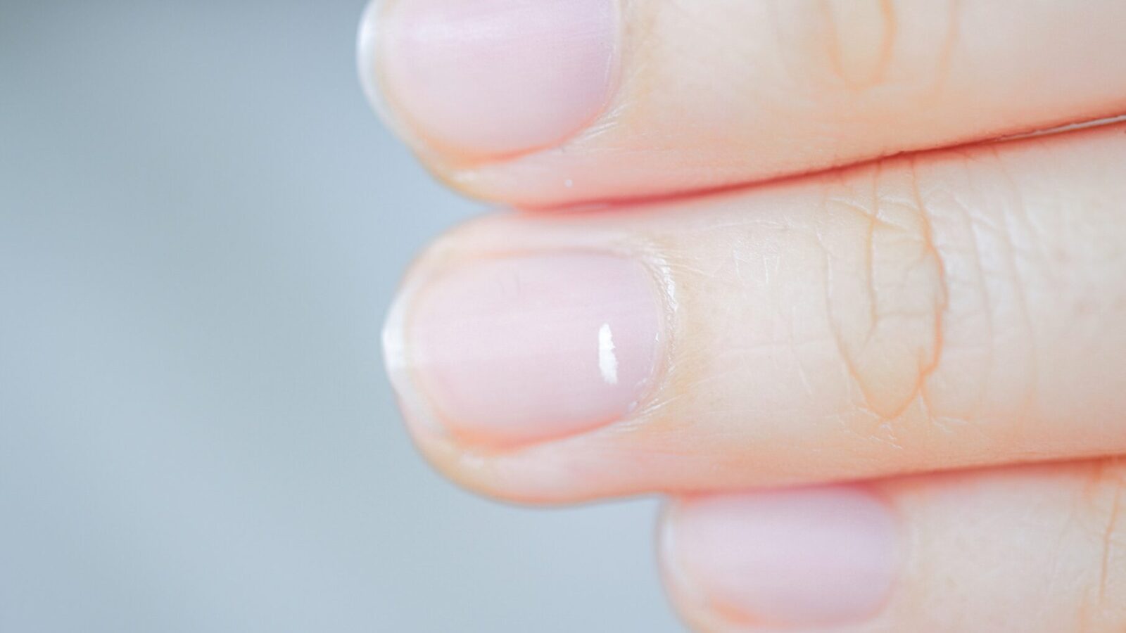 Weiße Flecken auf den Nägeln