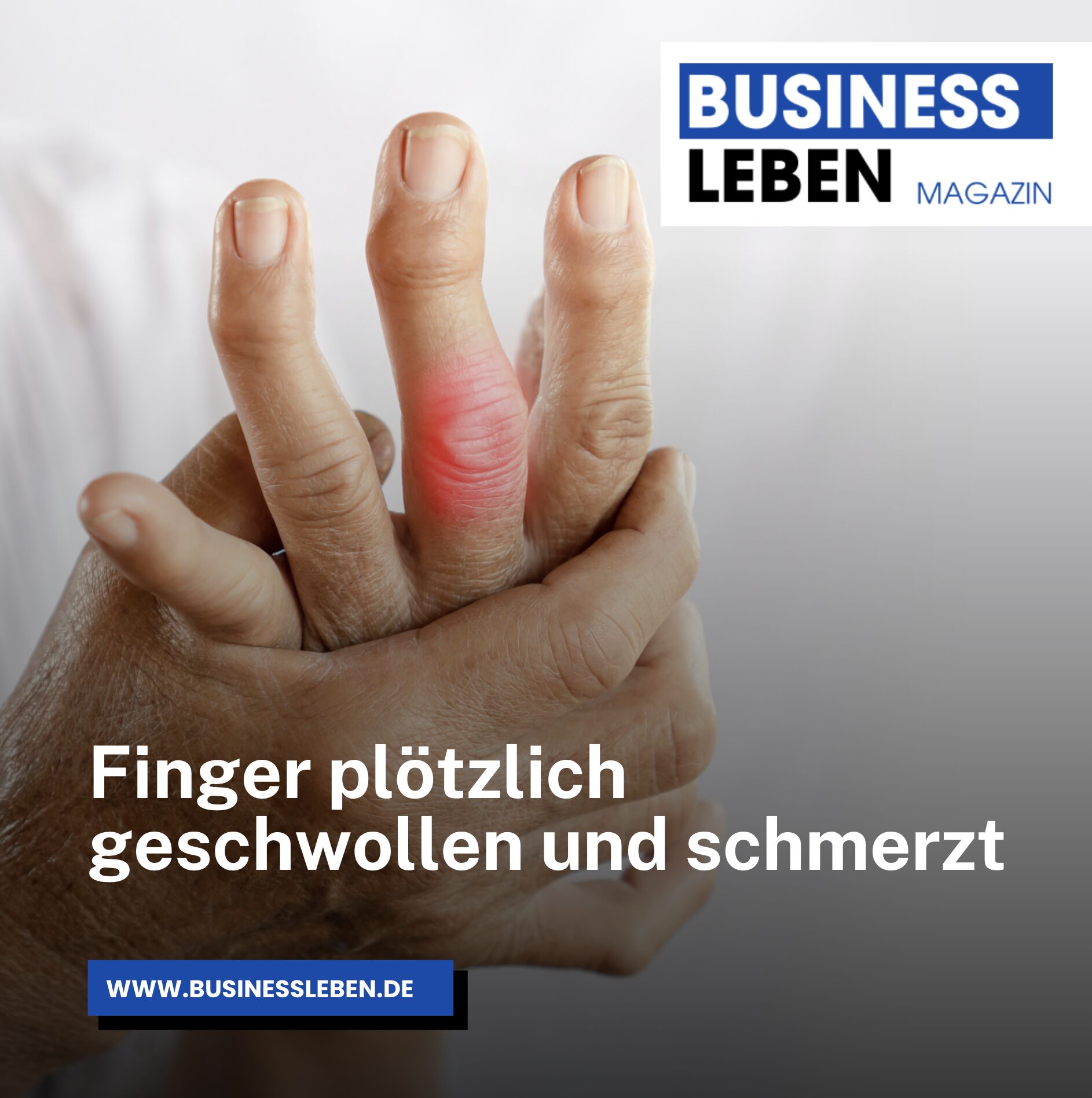 Finger plötzlich geschwollen und schmerzt – welche Ursachen kommen infrage? Finger plötzlich geschwollen und schmerzt – welche Ursachen kommen infrage?