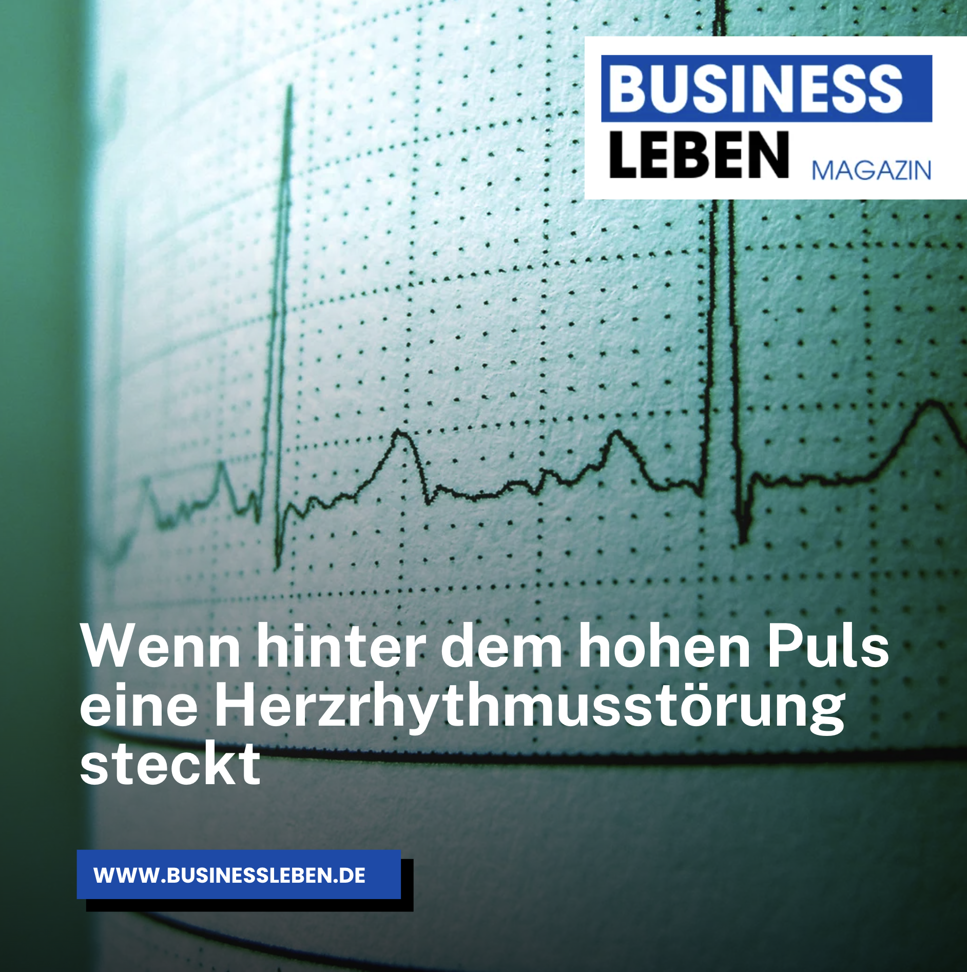 Wenn hinter dem hohen Puls eine Herzrhythmusstörung steckt Wenn hinter dem hohen Puls eine Herzrhythmusstörung steckt